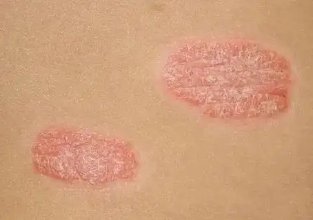 石家庄皮肤病医院哪家好一点